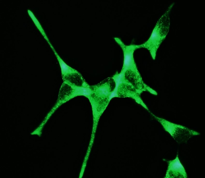 Figure 2. Indirect immunofluorescence staining of PSMA in the prostate cancer cell line LNCaP cells using MUB1510P, clone 107-1A4 (diluted 1:500). Note the membranous localization of PSMA.